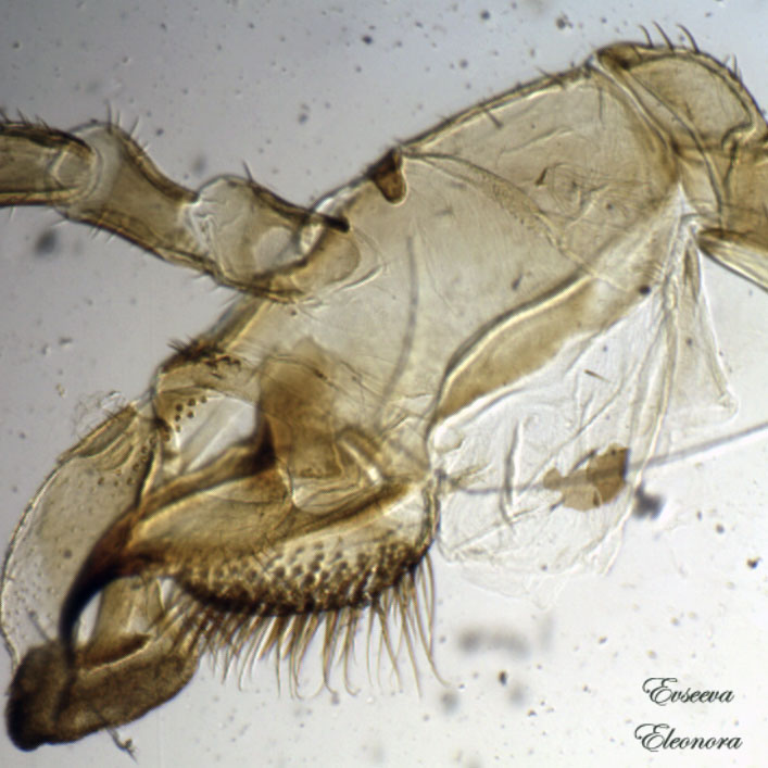Членистая конечность насекомого,
 микропрепарат сделан при помощи цифрового микроскопа, автор Евсеева Элеонора