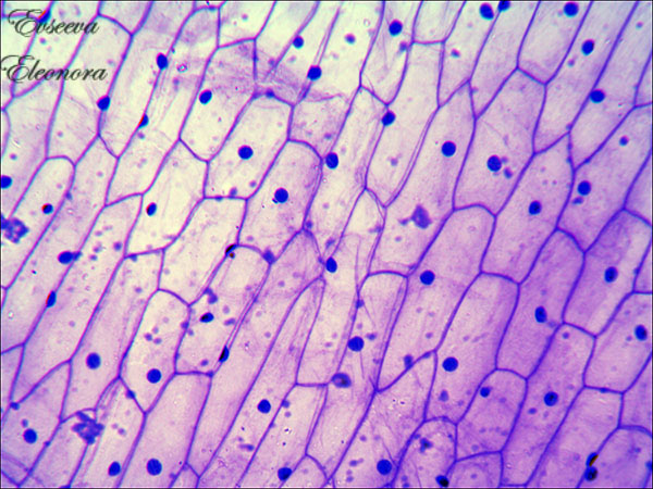 Кожица лука — окрашенный препарат под цифровым микроскопом, автор Евсеева Элеонора