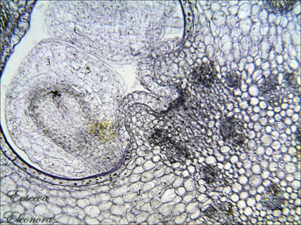 Завязь в семязачатке, фото сделано при помощи
цифрового микроскопа, автор Евсеева Элеонора