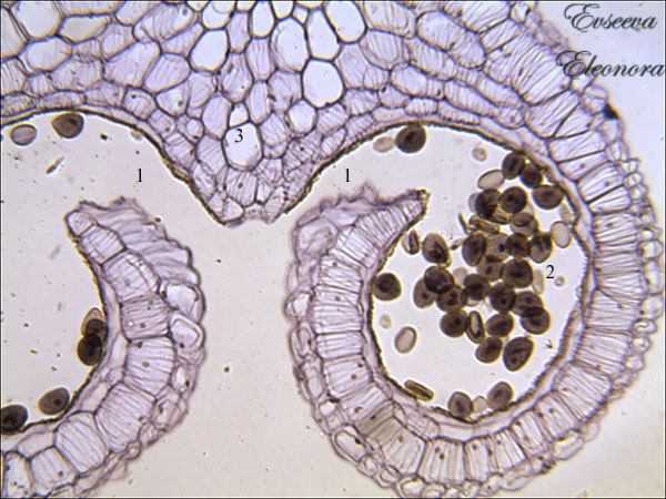 Пыльца в пыльниках, фото сделано при помощи
цифрового микроскопа, автор Евсеева Элеонора